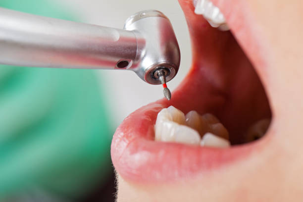 Professional Emergency Dentist in SC
